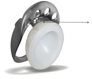 Acetabular Reinforcement Ring