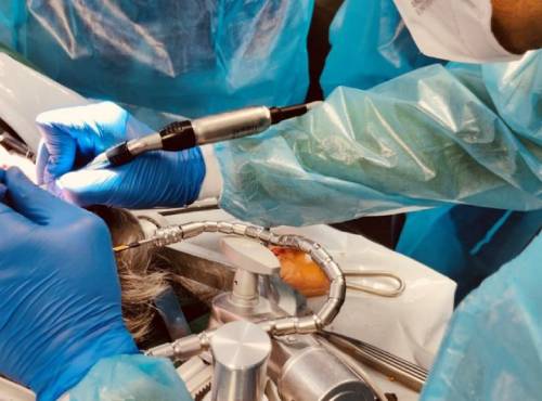 Corporate video - Production at adeor medical AG