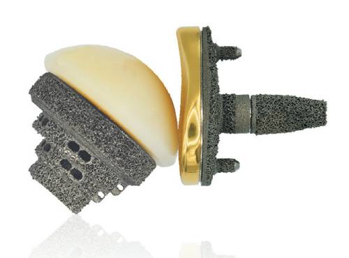 Mirai Anatomic to Reverse conversion - Permedica